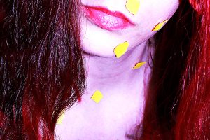 How to Accept Your Dermatillomania How to Accept Your Dermatillomania