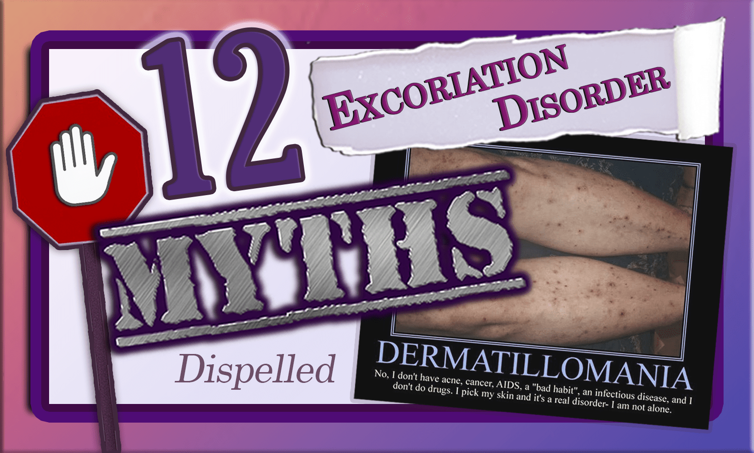 The #1 Misconception About Dermatillomania