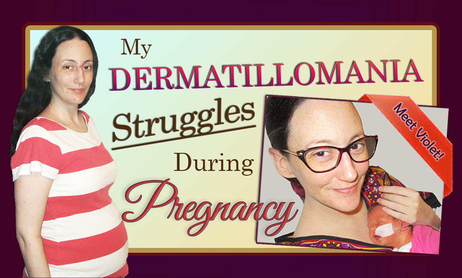 My Dermatillomania Challenges During Pregnancy