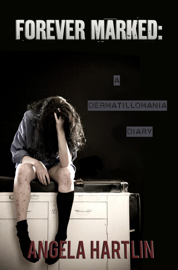 FOREVER MARKED: A Dermatillomania Diary