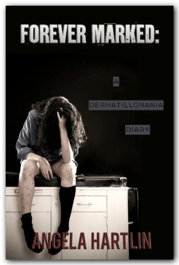 FOREVER MARKED: A Dermatillomania Diary